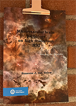 ISBN: 9789039363775 - Title: Microvascular brain pathology on high resolution MRI
